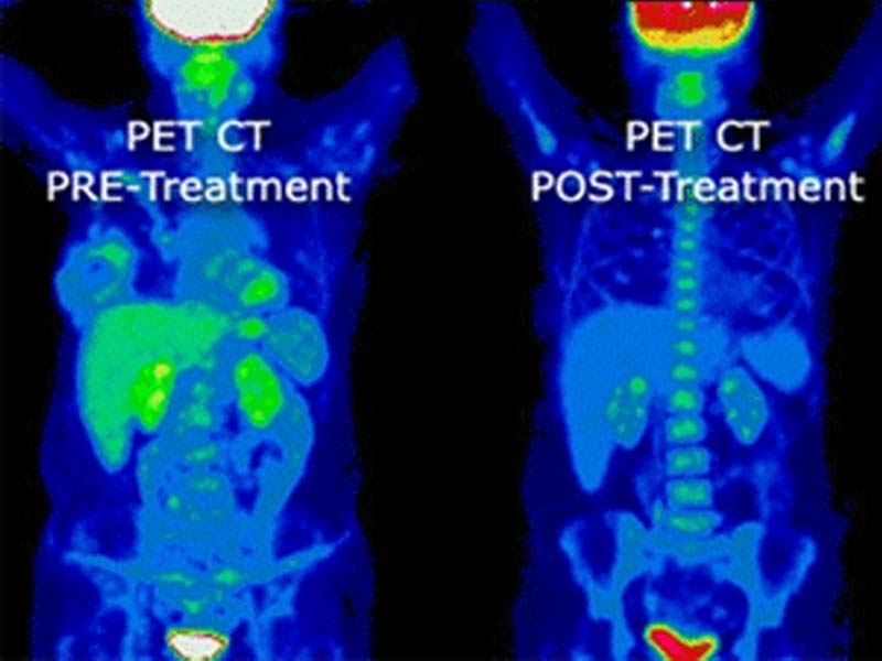 Desert Imaging PET/CT Scan